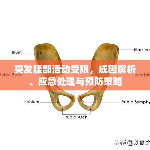 突發(fā)腰部活動受限，成因解析、應(yīng)急處理與預(yù)防策略