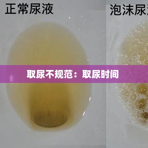 取尿不規(guī)范：取尿時(shí)間 